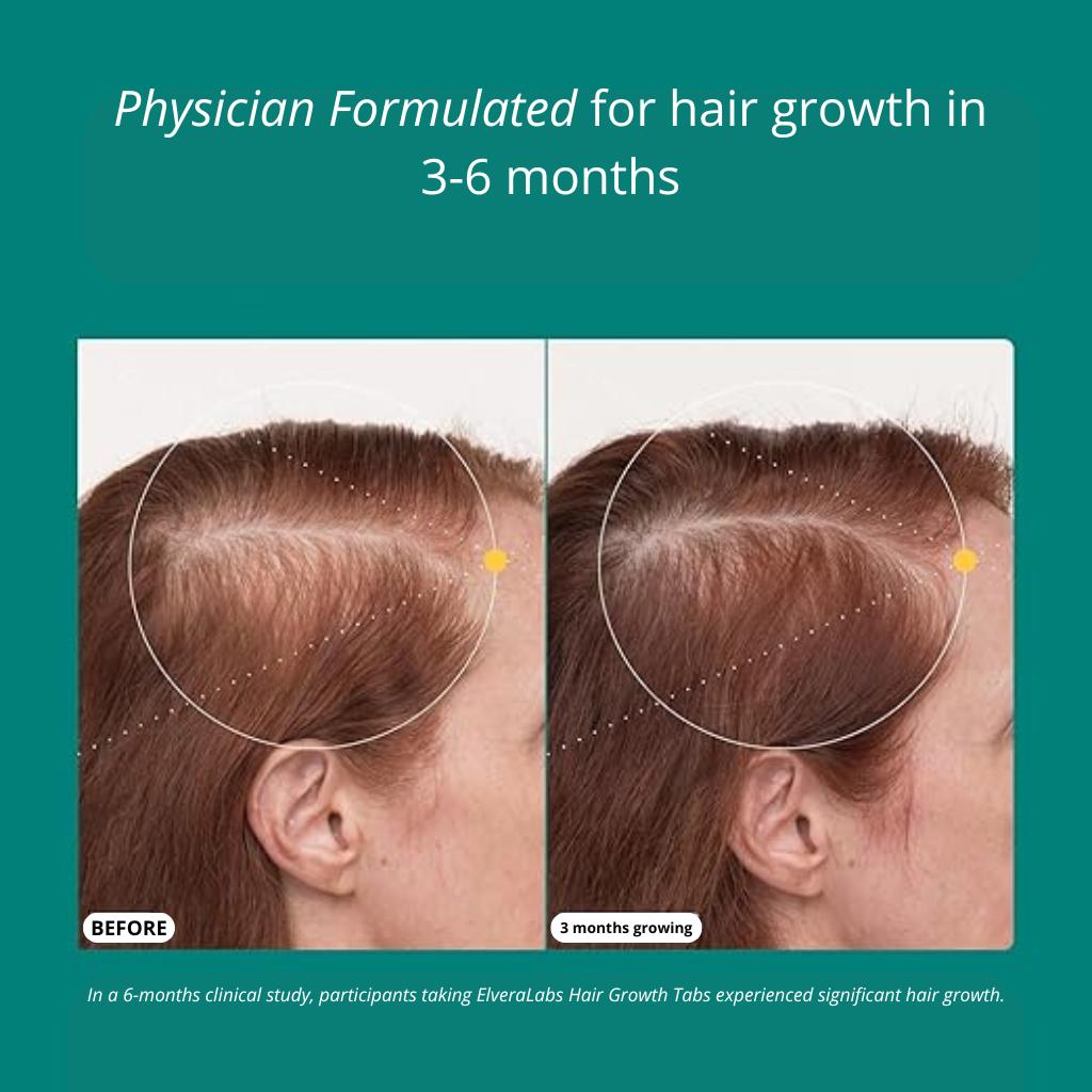Hair Recovery Tabs for Women